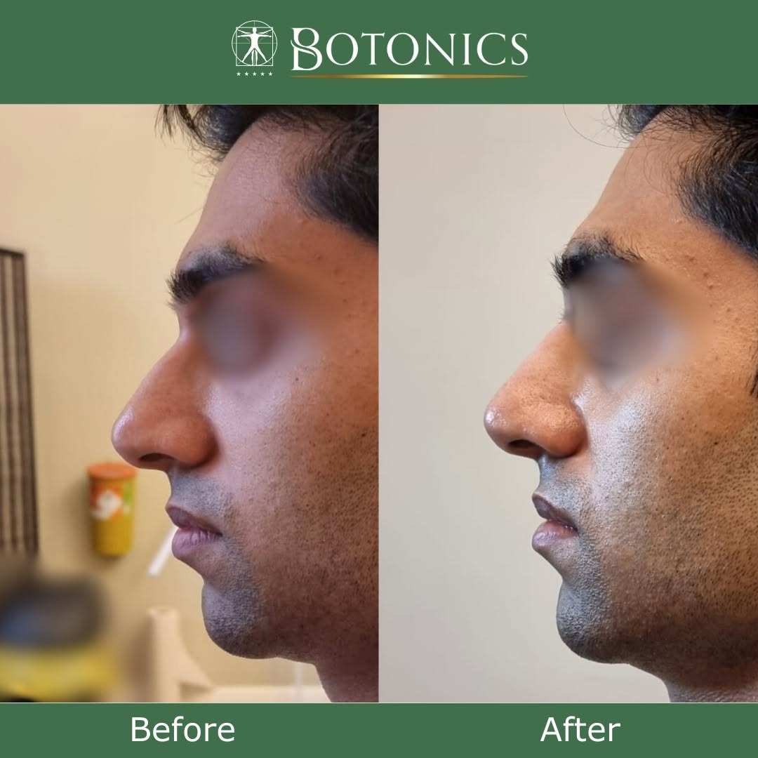 Botonics - Harley Street, Aesthetic Clinic