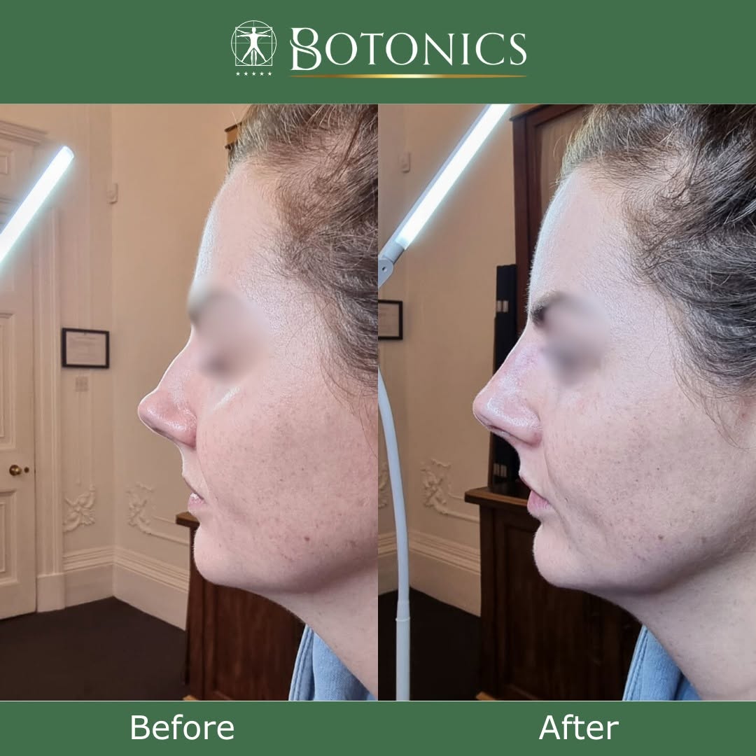 Botonics - Harley Street, Aesthetic Clinic