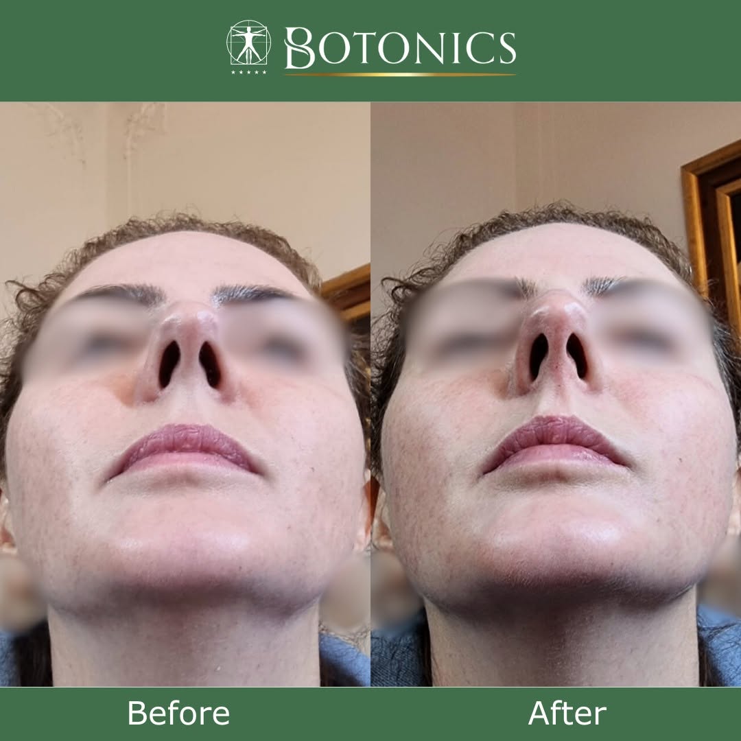 Botonics - Harley Street, Aesthetic Clinic