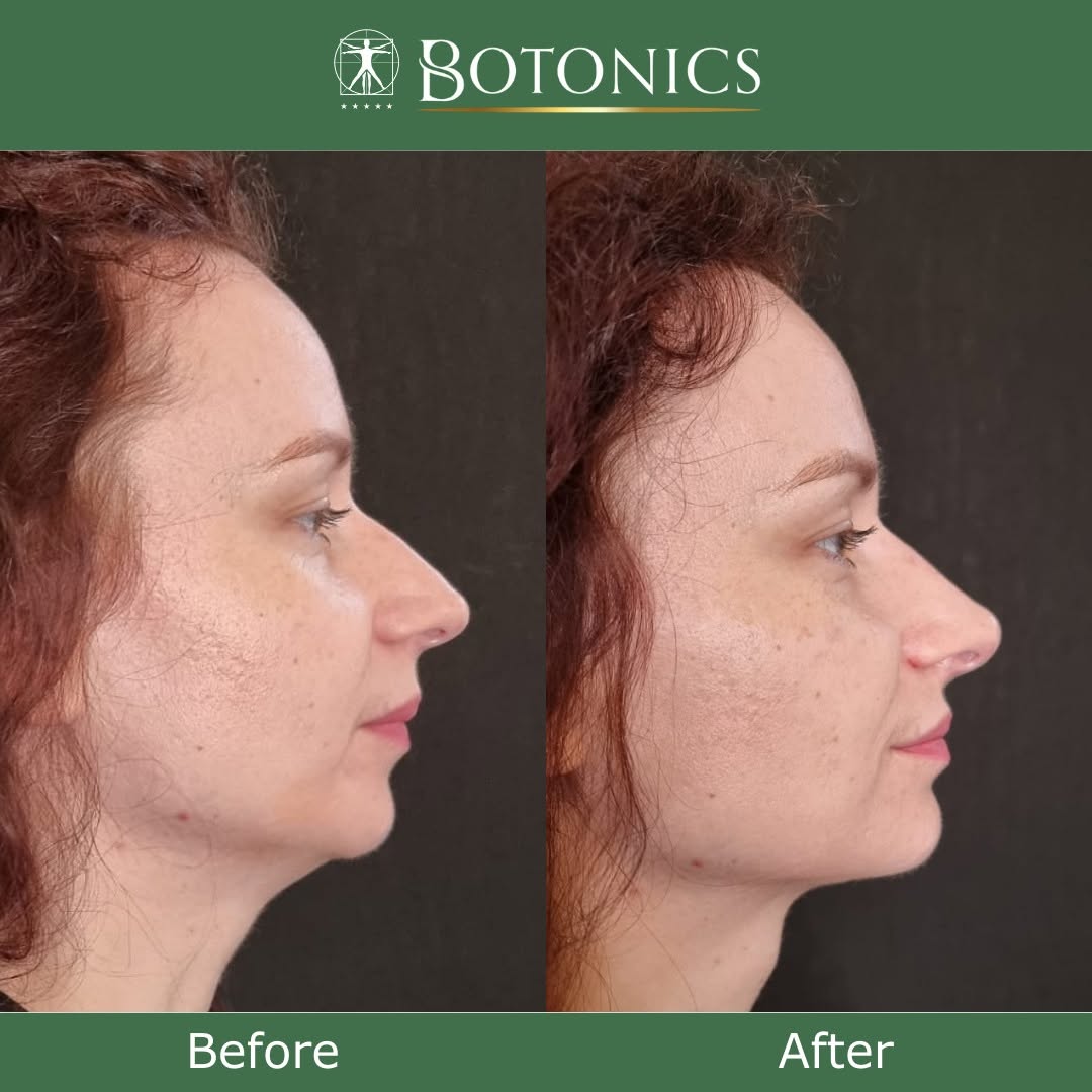 Botonics - Harley Street, Aesthetic Clinic