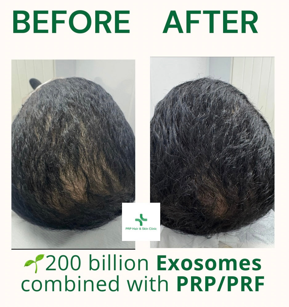 PRP Hair And Skin Clinic — photo 4