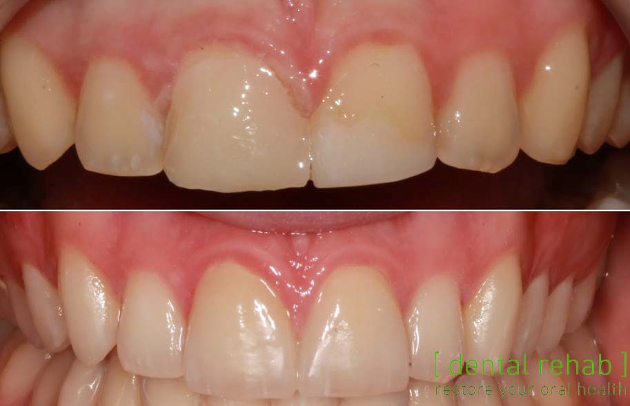 Newcastle Dental Implant Centre | Newcastle Advanced Dentistry — photo 2