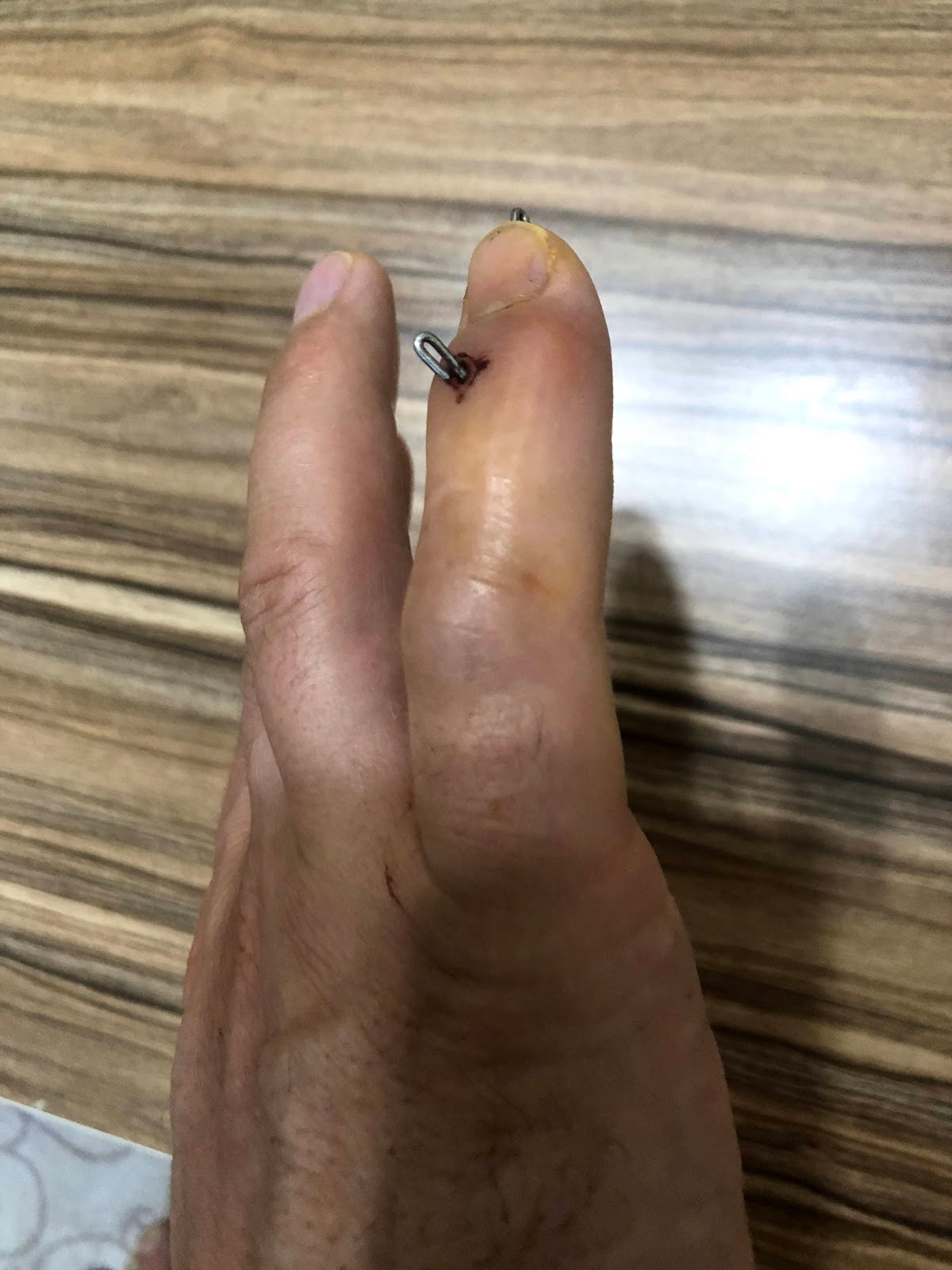 Op. Dr. Ahmet Savran — Dr.Visor photo 4