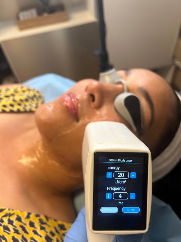 Statera Clinic | Hair Transplant | 1337 Sandvika