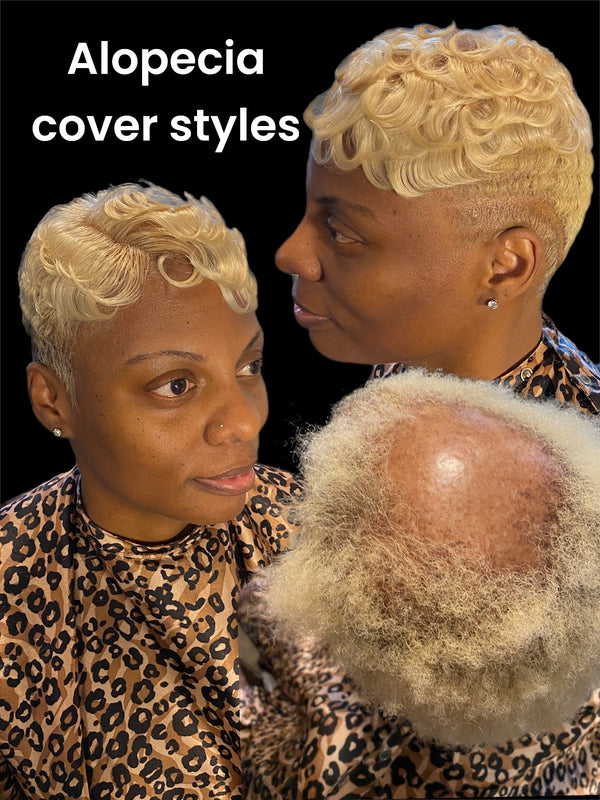 Kingdom Crowning LLC | Hair Transplant | Jackson, MS
