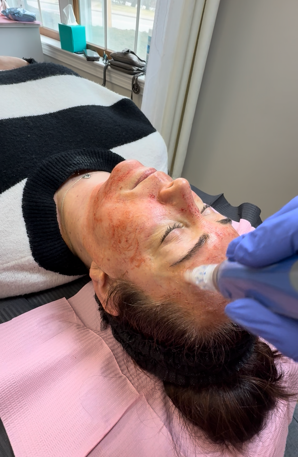 JOIA Med Spa & Wellness | Hair Transplant | Manchester, NH