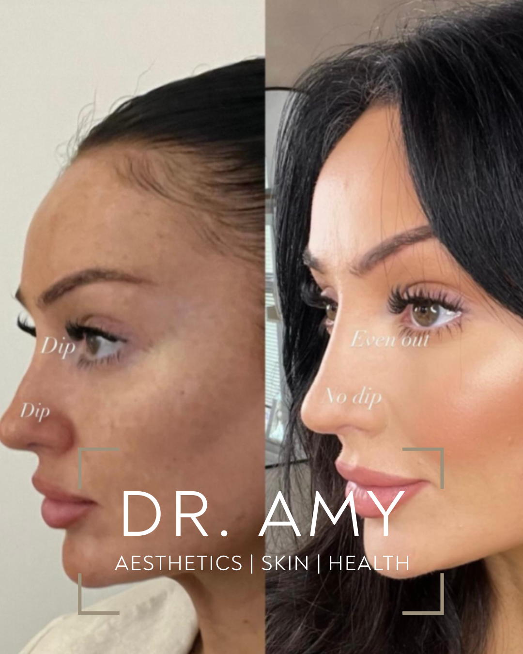 Dr Amy Aesthetics — photo 4