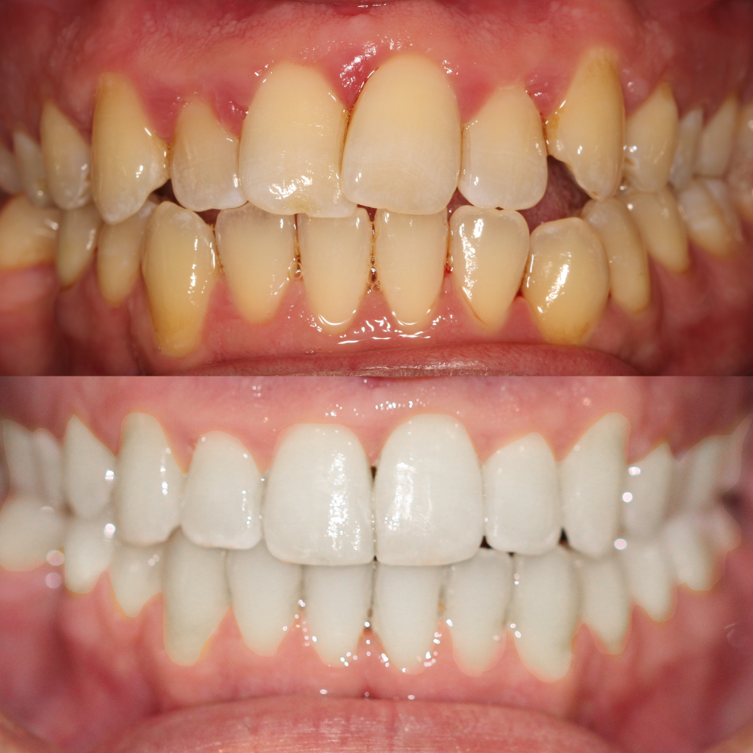 Pro Dental Clinic - Dental clinic in London, United Kingdom
