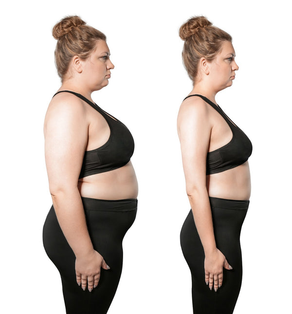 Slimmetry Medical Center | Bariatric Surgery | Metairie, LA