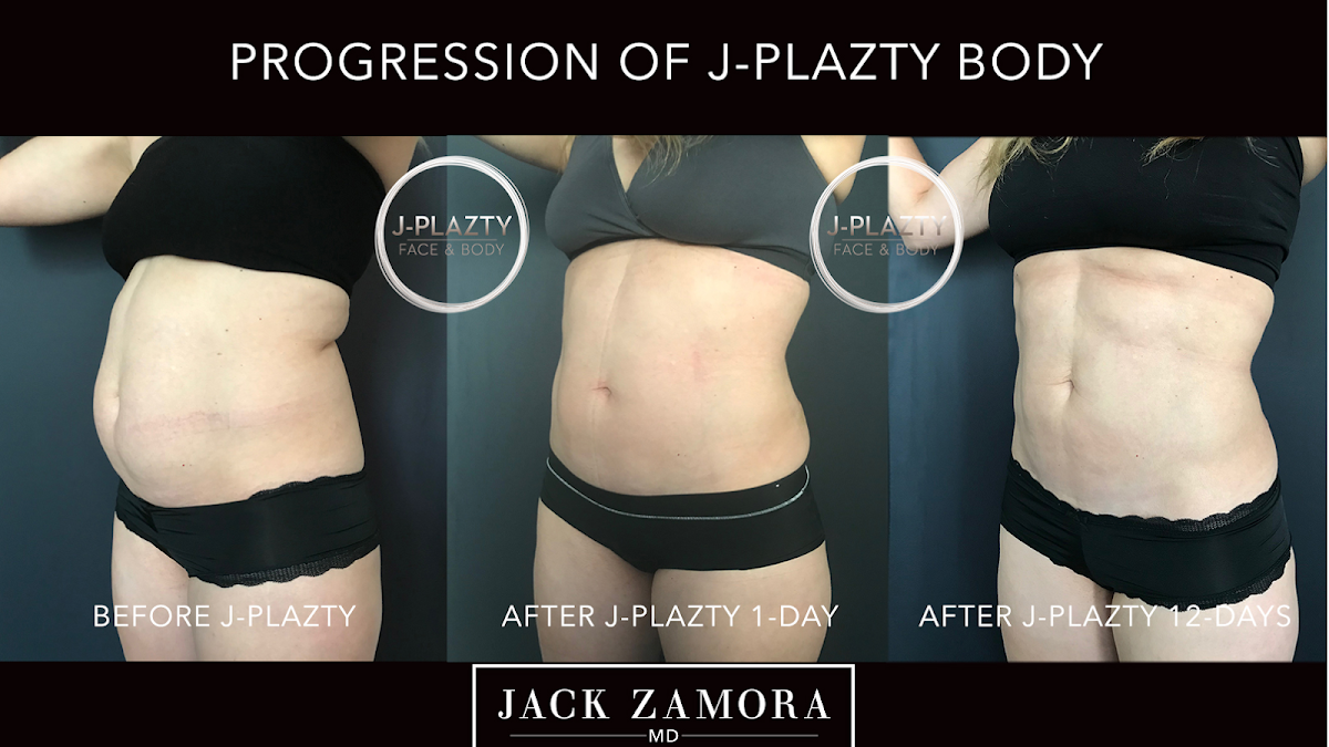 Jack Zamora MD Cosmetic Surgery and Aesthetics | Aesthetic Surgery | Denver, CO