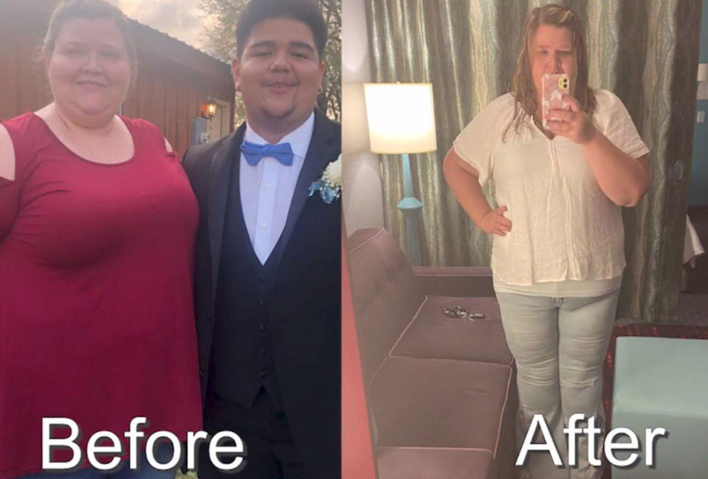 Ola Big Island Wellness Clinic | Bariatric Surgery | Waimea, HI
