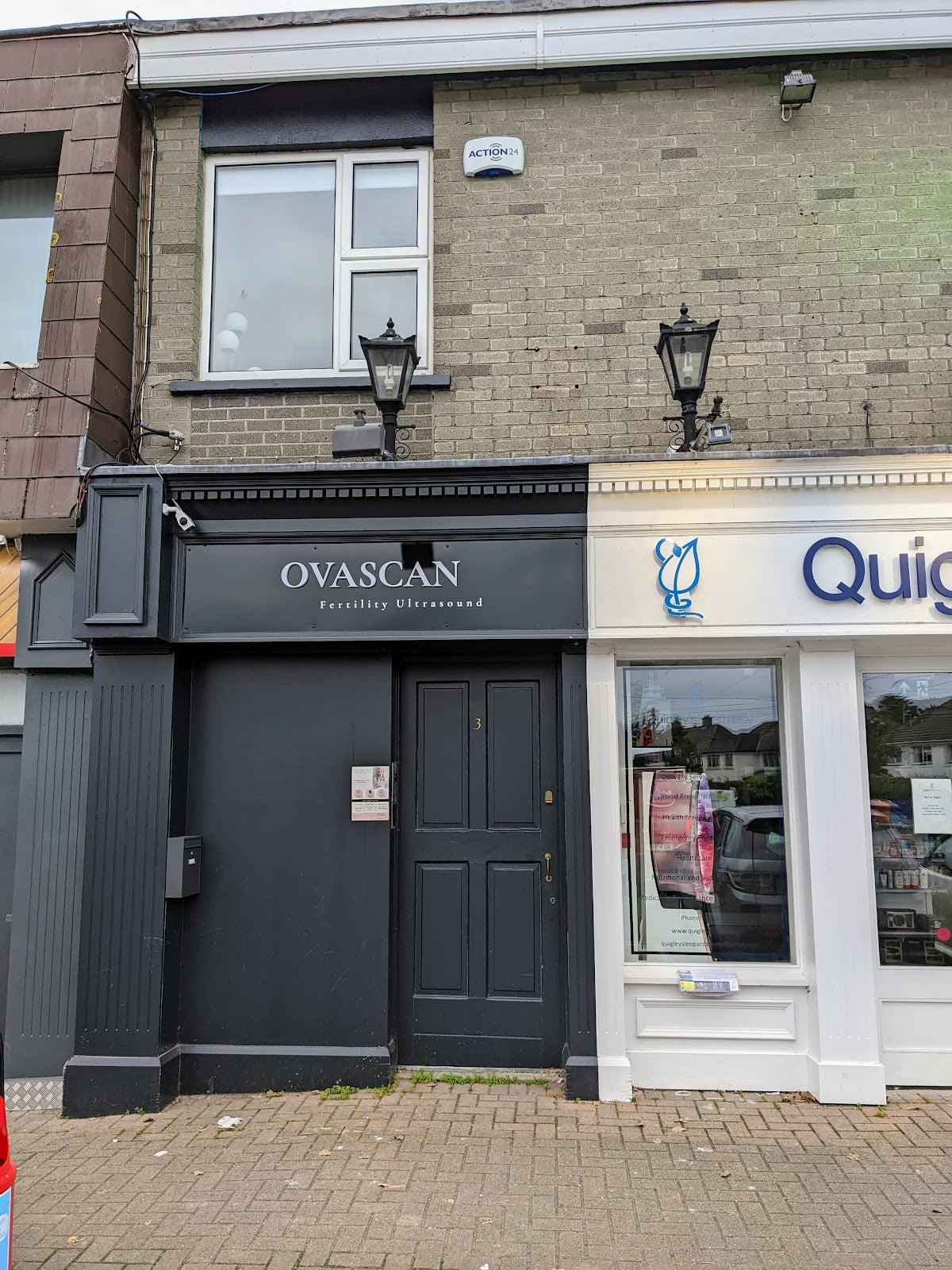 OvaScan | Fertility Ultrasound — Dr.Visor photo 5