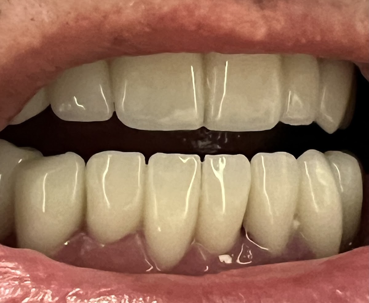 Dental Group | Dental | Bloomington, IN