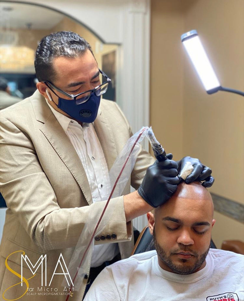 Scalp Micropigmetation Star Micro Art | Hair Transplant | Rockville, MD