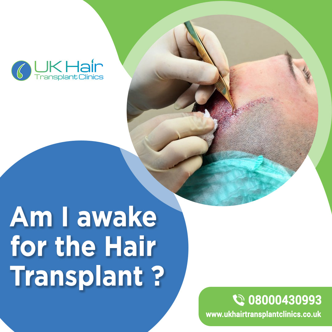 UK Hair Transplant Clinics Belfast — photo 4