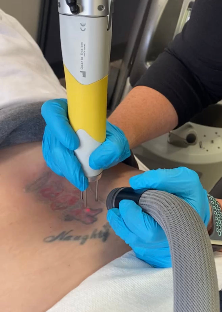 Revive Laser | Aesthetic Surgery | Grand Island, NE