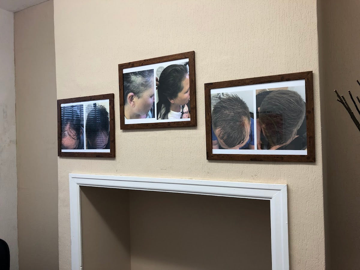 Leeds Hair Loss Clinic — photo 2