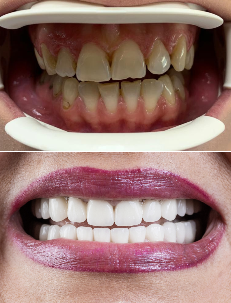 Belgrade Dental Tour - (Dental Tourism, Dental clinic in Belgrade Serbia) - Dental clinic in Beograd, Serbia