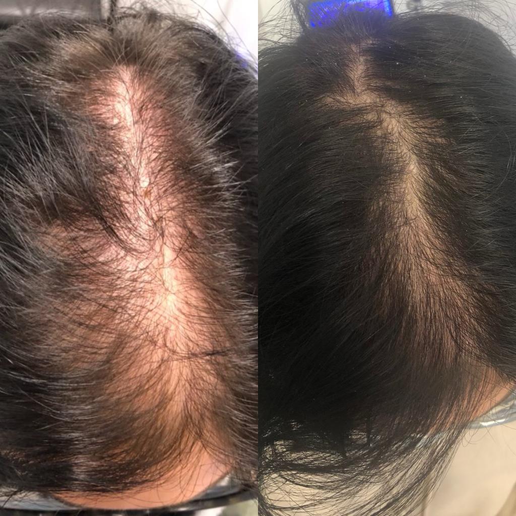 Newcastle Hair Loss Clinic — photo 3