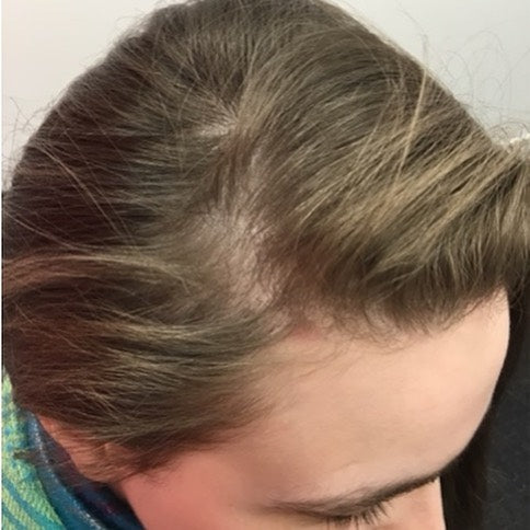 UK Hair Transplant Clinics Leeds — photo 2