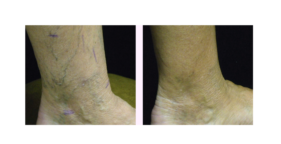 Cosmetic Laser Institute: Anthony Mamari MD | Aesthetic Surgery | Fort Thomas, KY