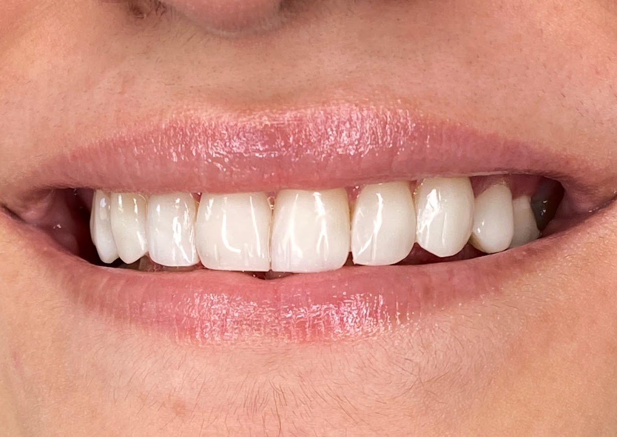 Elm Villa Dental Implants and Aesthetics Clinic | Chesterton | Newcastle Under Lyme | Dentist | Invisalign | Veneers — Dental Clinic in Newcastle