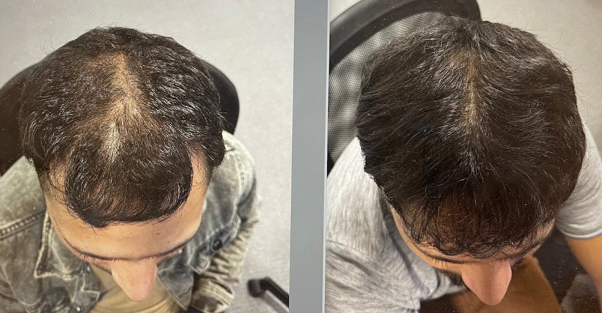 Premier Hair Restoration Clinic — Dr.Visor