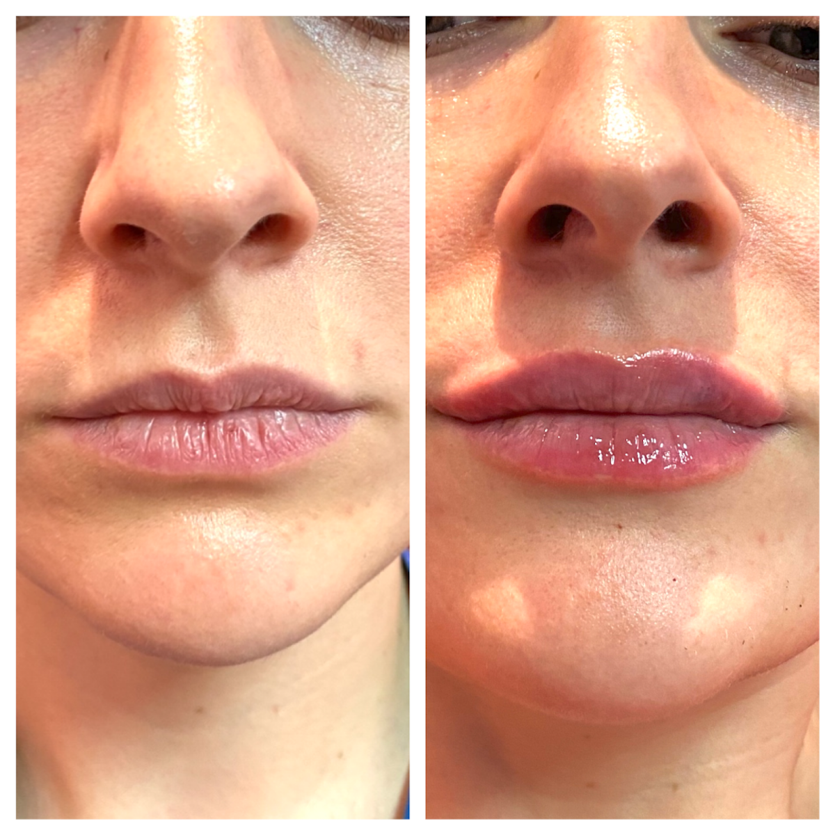 Derma Transform Aesthetics - Dr Kemi — Aesthetic Surgery Clinic in Manchester