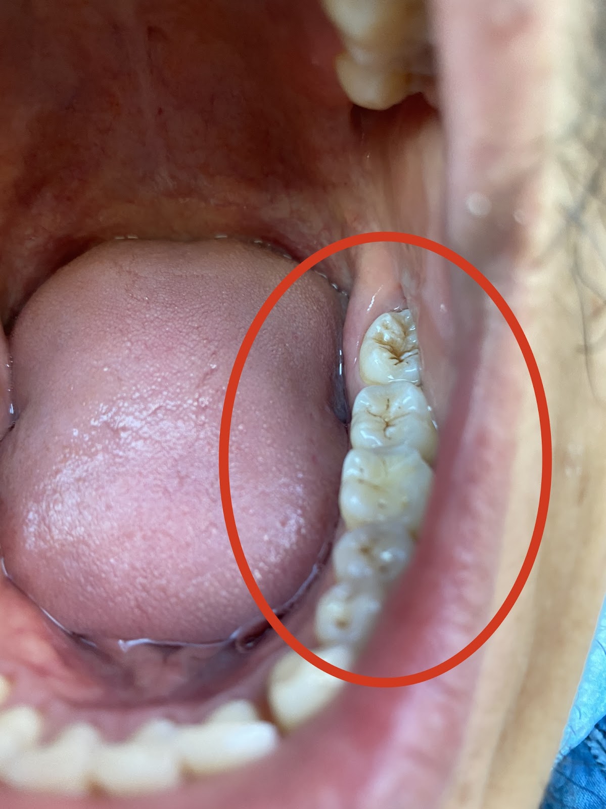 MiSmile Birmingham — Dr.Visor photo 5
