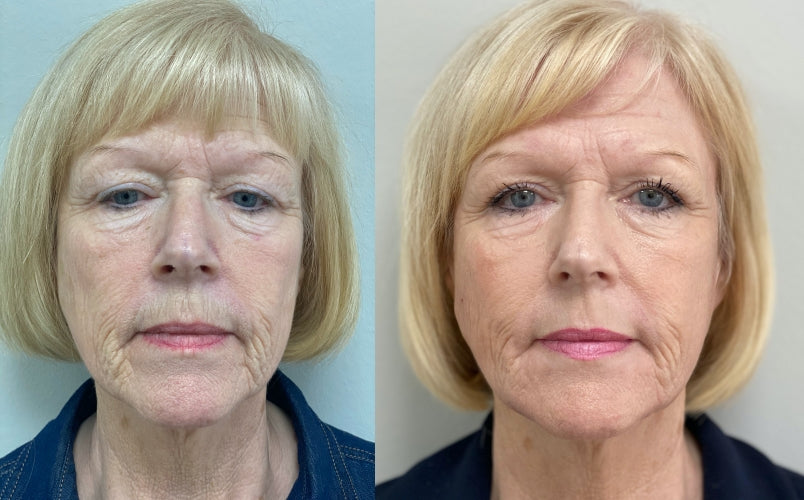 Ever Clinic - Aesthetic Surgery clinic in Glasgow, United Kingdom