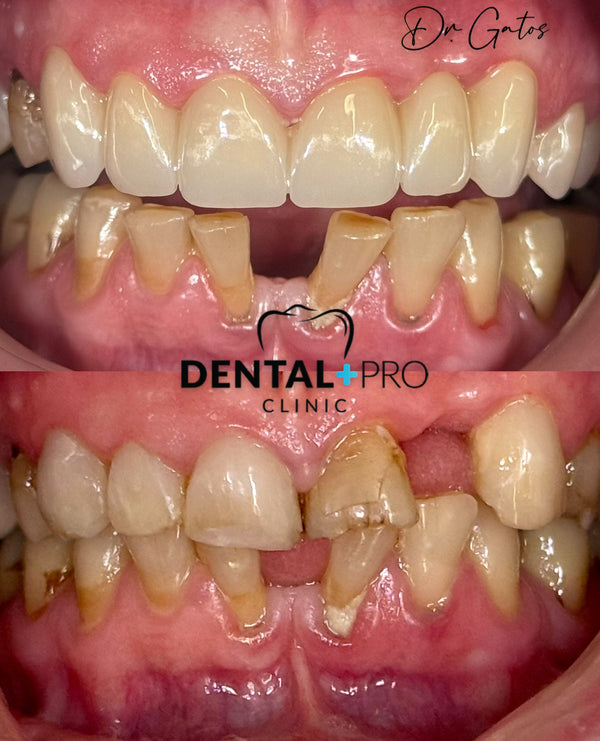 Dental Pro Clinic Athens