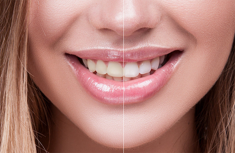 The Dentist at Liberty Place - Birmingham — Dr.Visor photo 5