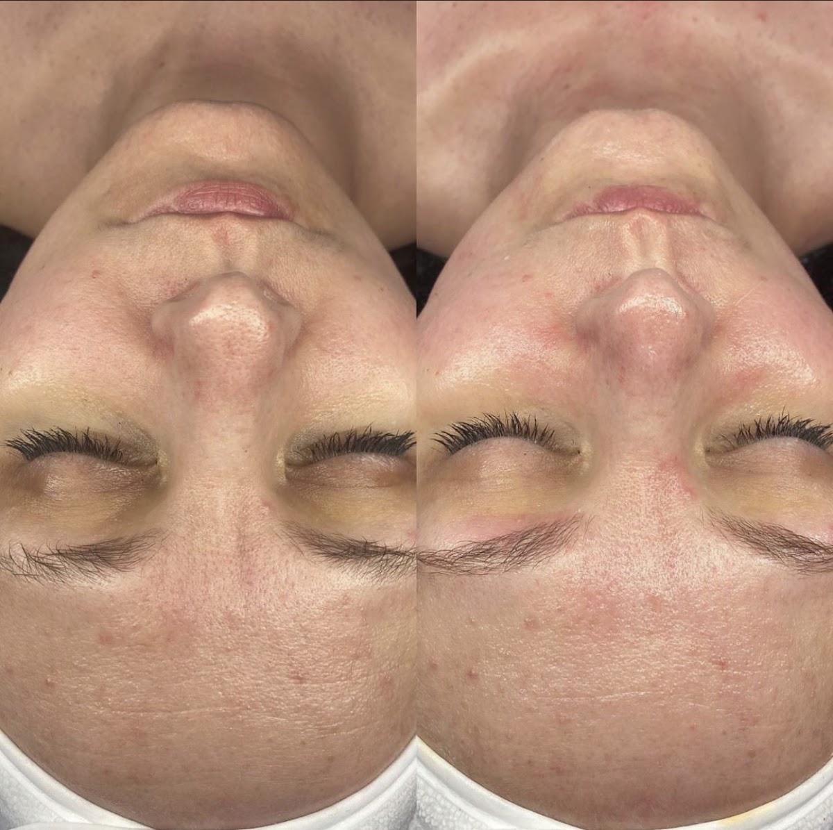 Aurora Aesthetics Co | Aesthetic Surgery | Ketchikan, AK