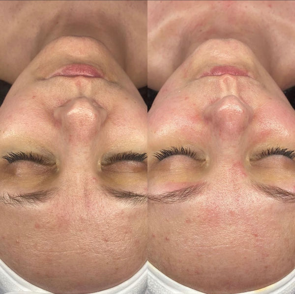 Aurora Aesthetics Co | Aesthetic Surgery | Ketchikan, AK