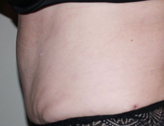 Zieg Plastic Surgery Center | Aesthetic Surgery | Evansville, IN