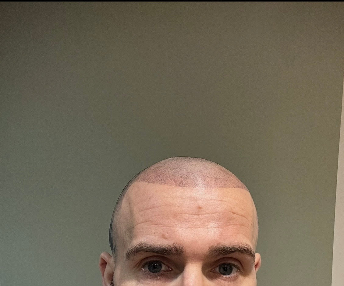Scalp Ahead — Dr.Visor