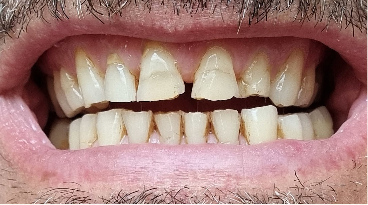 Perla Oral and Maxillofacial Clinic — Dr.Visor photo 4