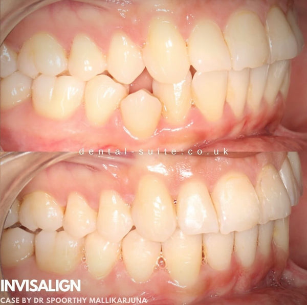 The Dental Suite - Leicester | Dental | Leicester