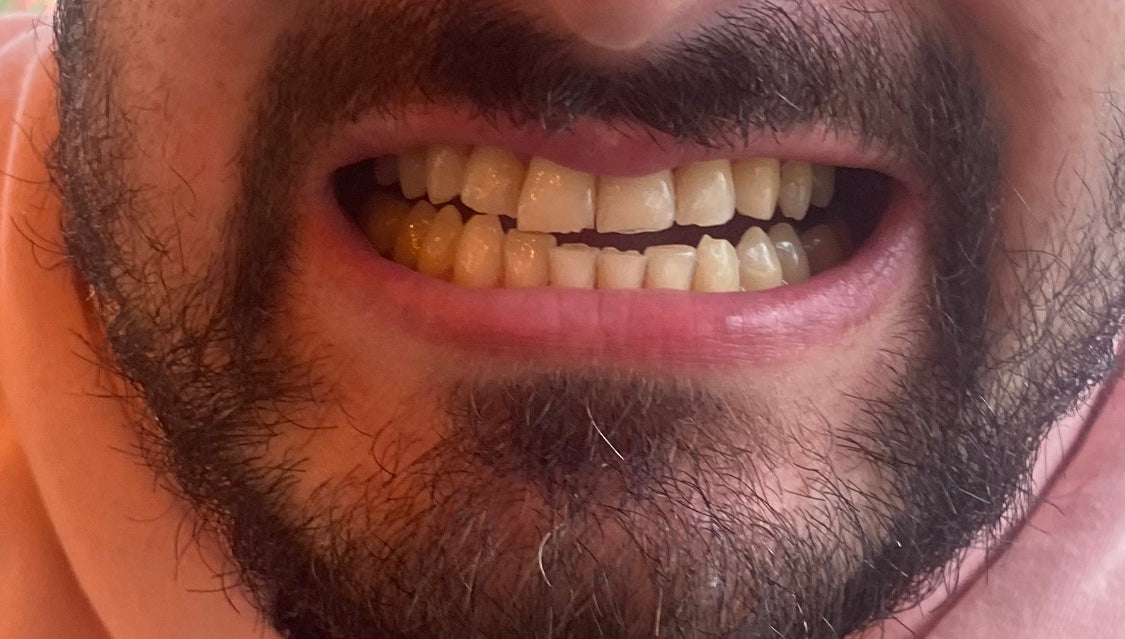Dental Clinic Antalya — Dr.Visor photo 3