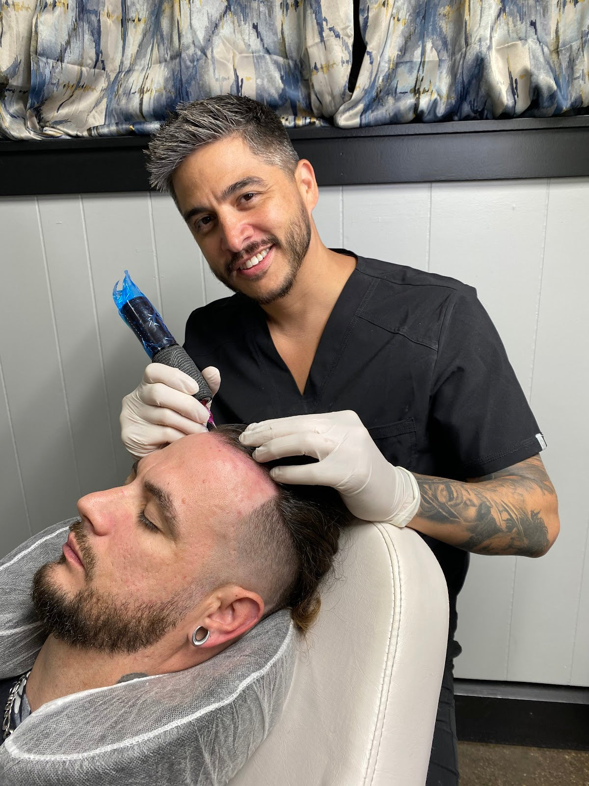 New Style Scalp Micropigmentation Illinois | Hair Transplant | Moline, IA