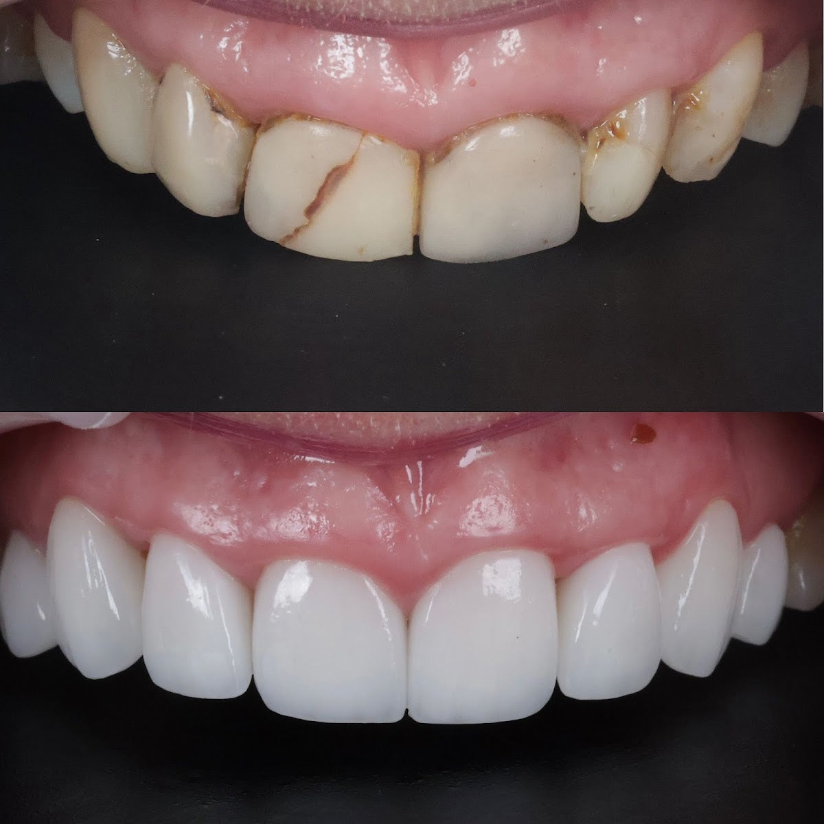 Cosmetic Smile Clinic - Birmingham Cosmetic Dentist — Dental Clinic in Birmingham