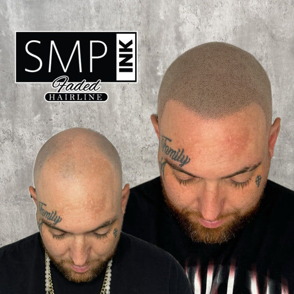 SMP INK | Hair Transplant | Las Vegas, NV
