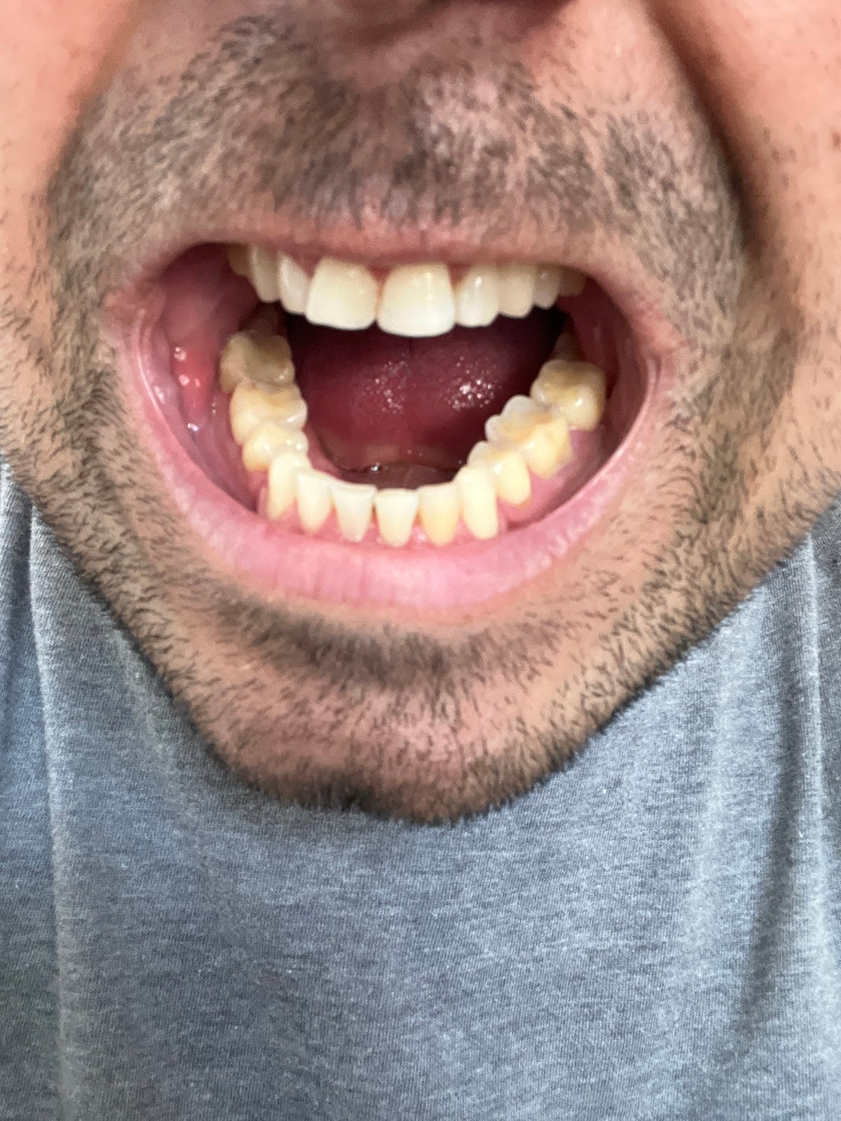 Summit Dental Health | Dental | Sioux City, IA
