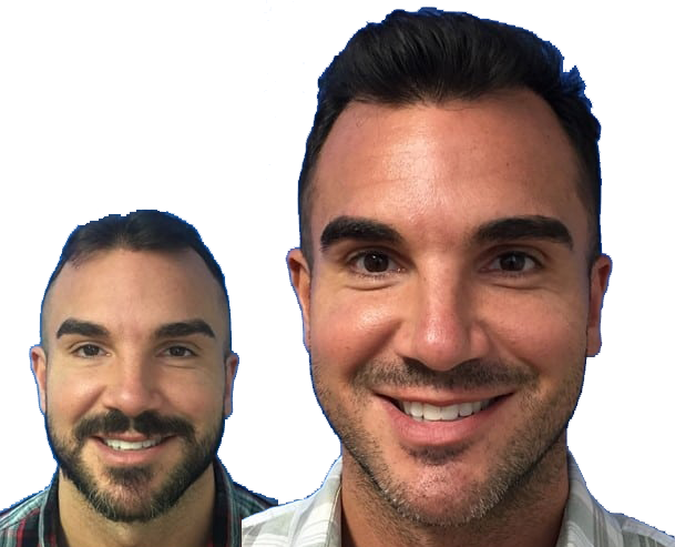 Scott A. Boden, MD | Hair Transplant | Wethersfield, CT