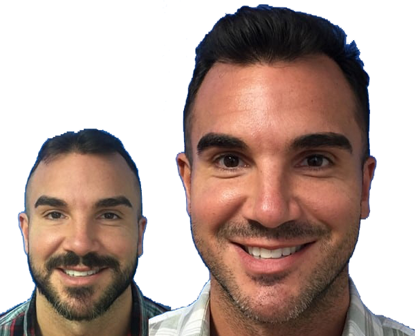 Scott A. Boden, MD | Hair Transplant | Wethersfield, CT