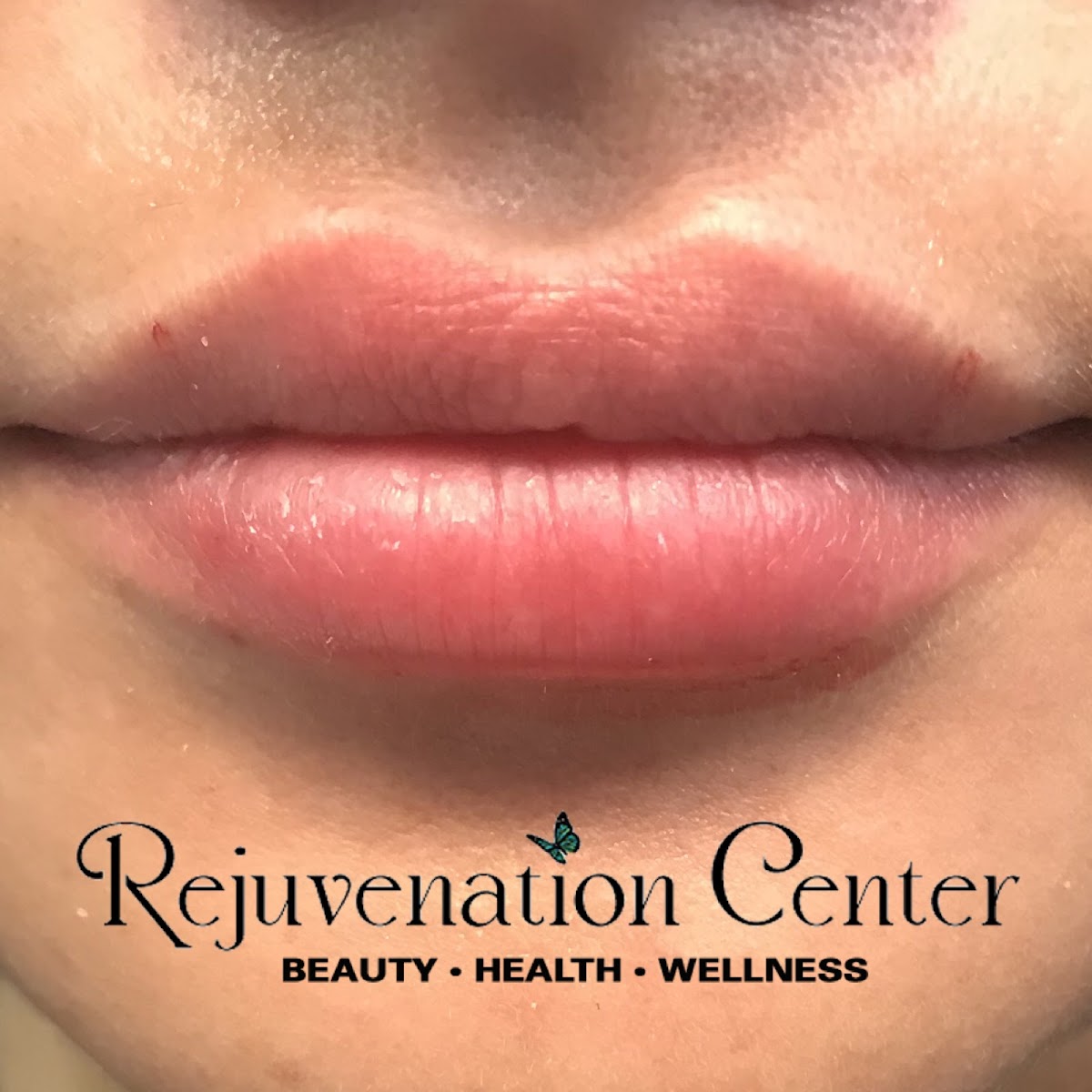 Rejuvenation Center | Hair Transplant | Wheeling, WV