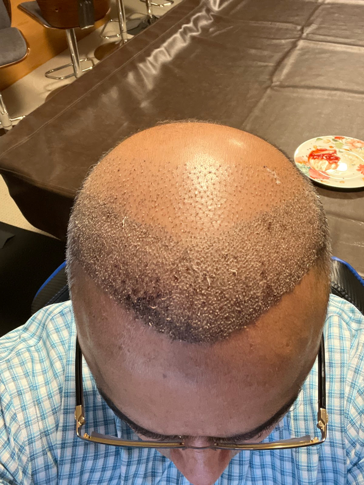 American Aesthetics - Hair Restoration and Aesthetic Surgery Medical Center — Dr.Visor photo 4
