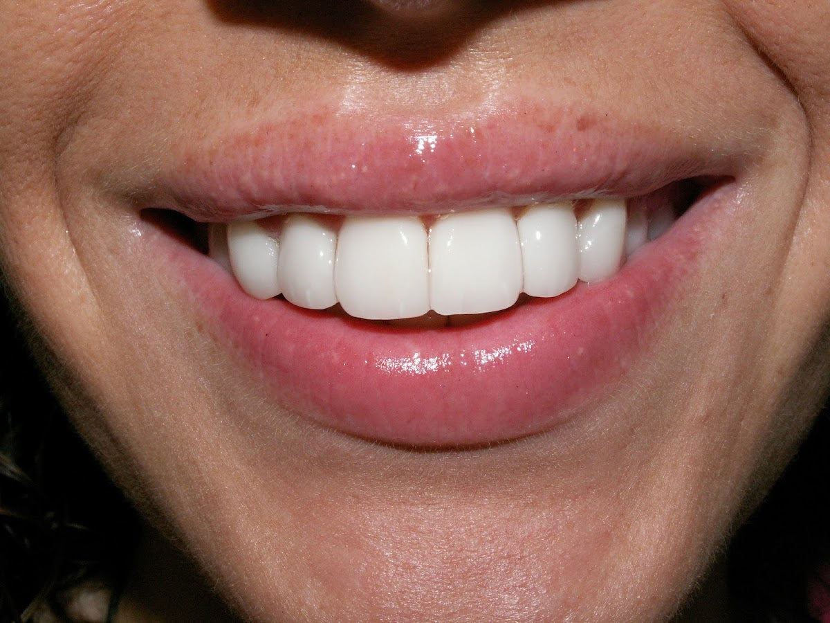 The London Centre for Cosmetic Dentistry — photo 4