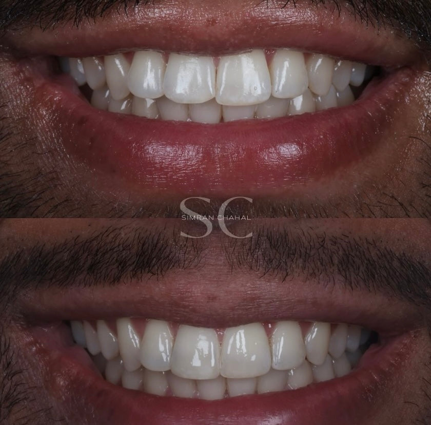 London Dental Implant — Dental Clinic in London
