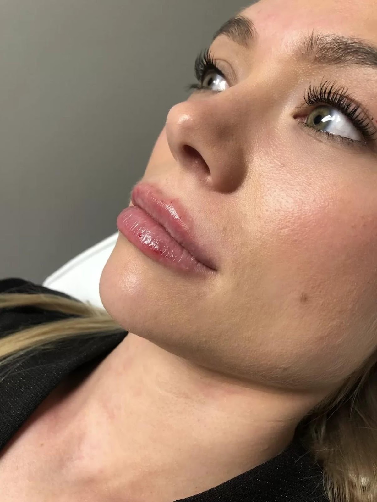Aesthetics by Abby | Aesthetic Surgery | Hermantown, MN